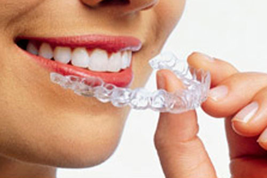 Apparecchi Invisibili