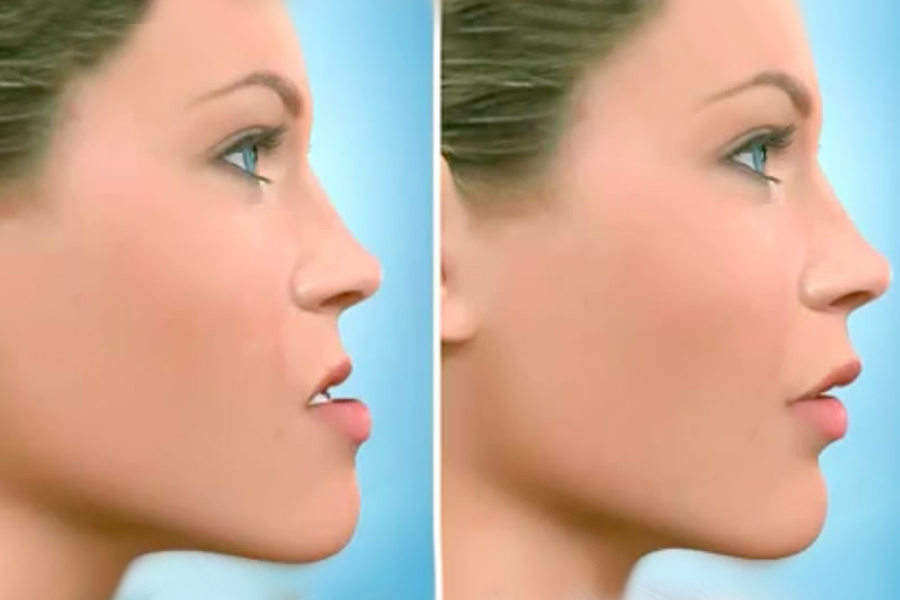 Chirurgia Maxillo Facciale